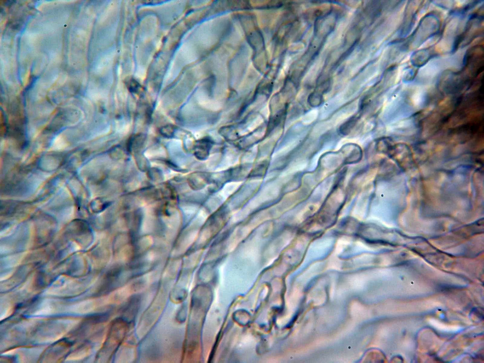 Microscopía de Mycena meliigena - 13 - Pileipellis 1